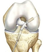 Anterior Ligament