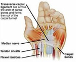 Carpal Tunnel