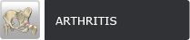 Arthritis