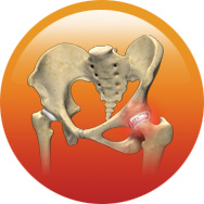 Total Hip Replacement